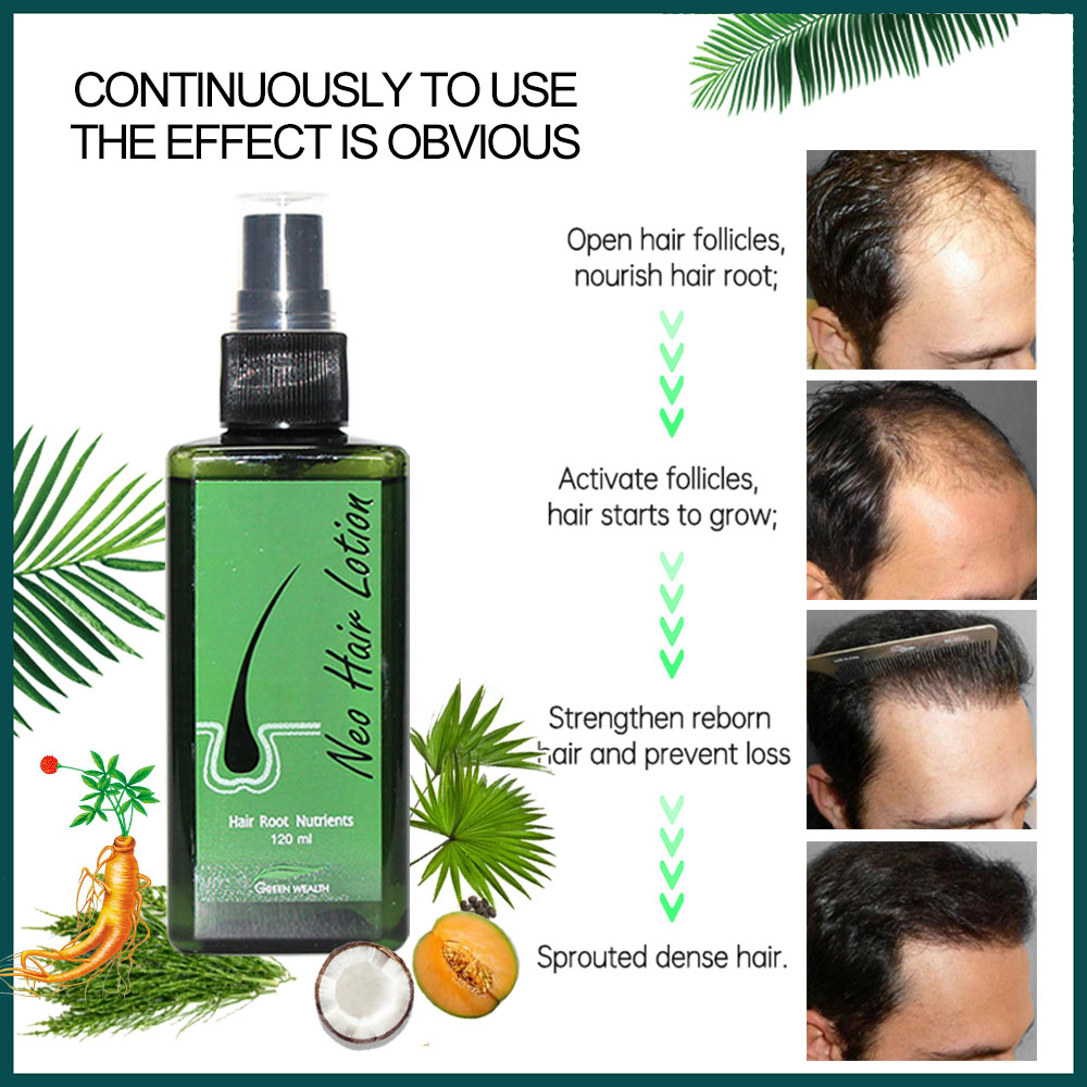 Lotion Rambut Neo Asli 120ml P - Hair Care Thailand ulasan dan harga