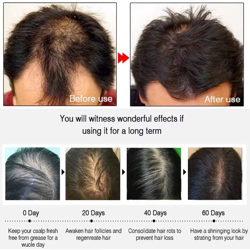 Semprotan Penumbuh Rambut Jahe - Hair Care Growth ulasan dan harga